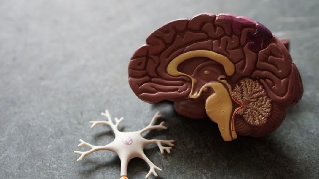 Anatomical model of a human brain